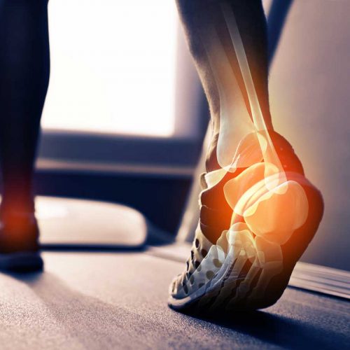 Osteoporosis: How to have strong, healthy bones